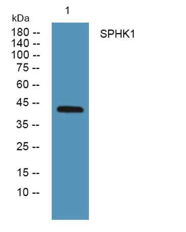 SPHK1 rabbit pAb