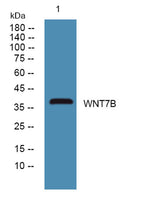WNT7B rabbit pAb 50µL/100µL