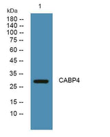 CABP4 rabbit pAb
