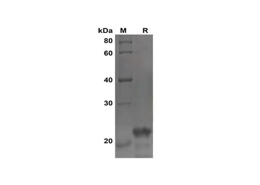 SDS-PAGE analysis of Human FGF21 proteins, 2 μg/lane of Recombinant Human FGF21 proteins was resolved with SDS-PAGE under reducing conditions, showing bands at 22 kDa.
