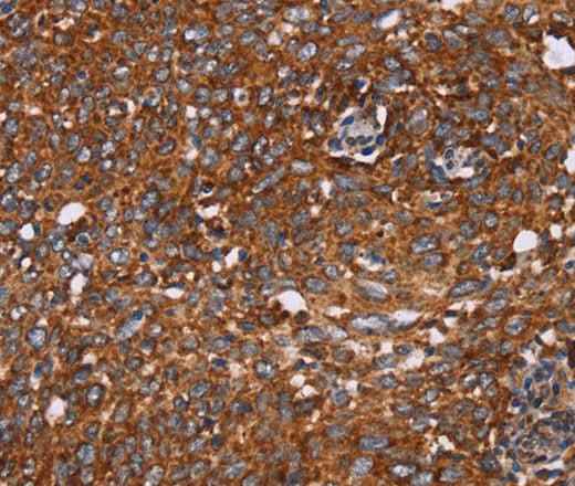 Anti-Human/Mouse CYP2W1 Antibody