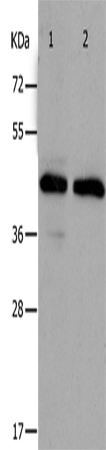 Anti-Human PAWR Antibody - ABMIUM