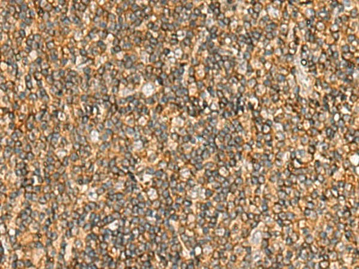 Immunohistochemistry of paraffin-embedded Human tonsil tissue using NLRC4 Polyclonal Antibody at dilution of 1:50(×200)