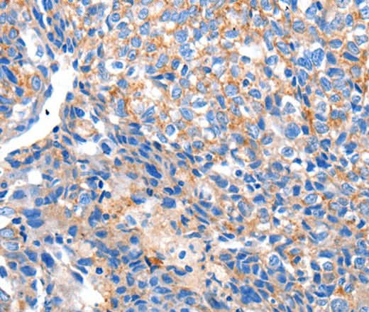 Anti-Human/Mouse/Rat HCN2 Antibody - ABMIUM