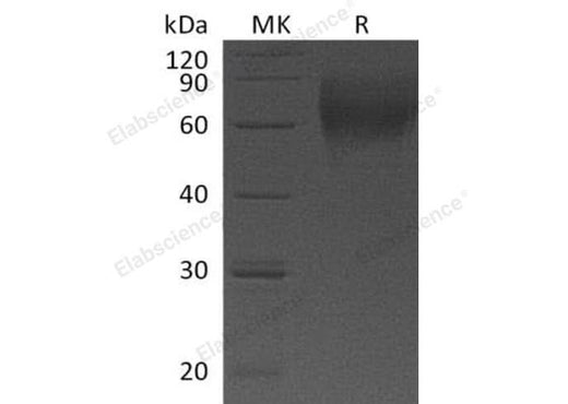 Recombinant Human IL-23 Recetor/IL-23R Protein (His Tag) - ABMIUM