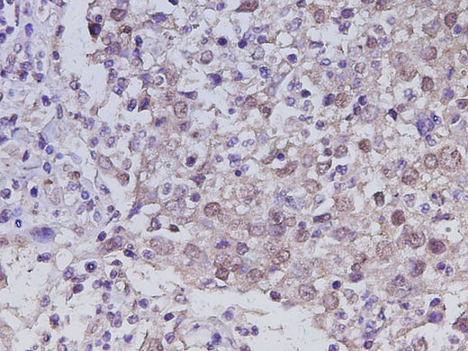Anti-Human RUNX2 Antibody - ABMIUM