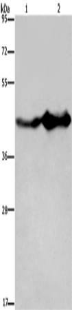 Anti-Human/Mouse/Rat GLUL Antibody - ABMIUM
