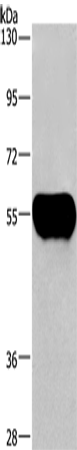 Anti-Human AHSG Antibody - ABMIUM