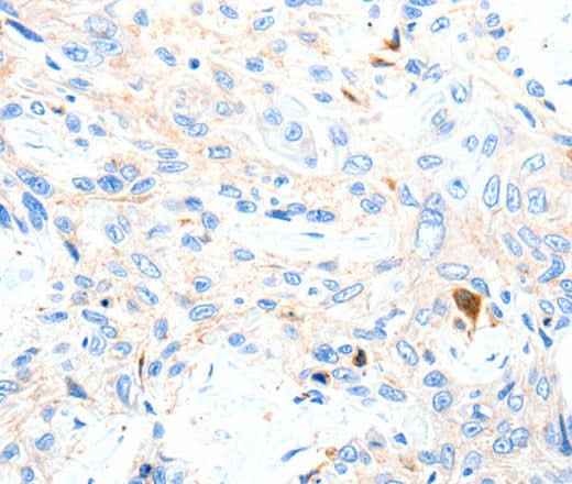 Anti-Human/Mouse/Rat P2RY1 Antibody