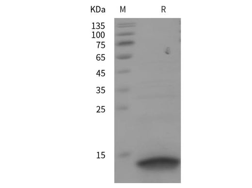 SDS-PAGE analysis of Human CXCL14 proteins, 2 μg/lane of Recombinant Human CXCL14 proteins was resolved with SDS-PAGE under reducing conditions, showing bands at 10 kDa.