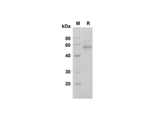 SDS-PAGE analysis of Human Fetuin B proteins , 2 μg/lane of Recombinant Human Fetuin B proteins was resolved with SDS-PAGE under reducing conditions , showing bands at 55 kDa.
