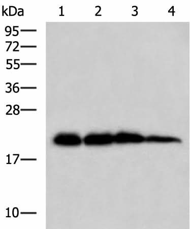 Western blot analysis of Rat brain tissue Hela HepG2 and A172 cell lysates using HPCAL1 Polyclonal Antibody at dilution of 1:1000