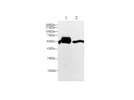 Anti-Mouse/Rat Lbp Antibody - ABMIUM