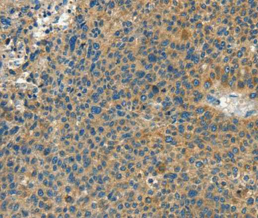 Anti-Human CALCA Antibody