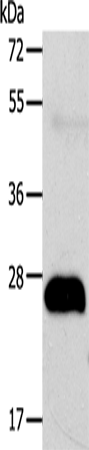 Anti-Human AGPAT2 Antibody - ABMIUM
