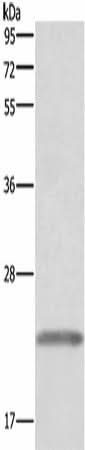 Anti-Human GH1 Antibody