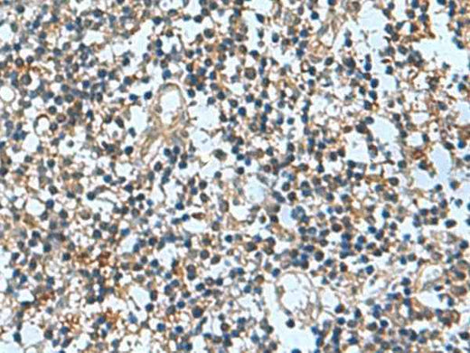 Immunohistochemistry of paraffin-embedded Human tonsil tissue using TRO Polyclonal Antibody at dilution of 1:65(×200)