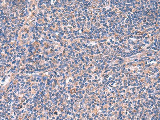 Immunohistochemistry of paraffin-embedded Human tonsil tissue using MPP1 Polyclonal Antibody at dilution of 1:50(×200)