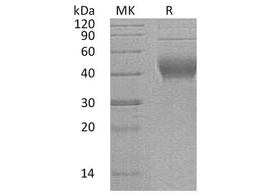 Recombinant Human IL-22BP/IL-22RA2 Protein (His Tag) - ABMIUM