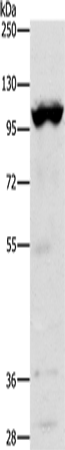 Anti-Human/Mouse TRPM5 Antibody - ABMIUM