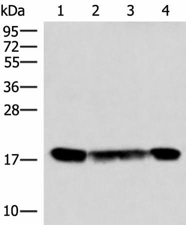 Western blot analysis of 293T and 231 cell lysates using PEMT Polyclonal Antibody at dilution of 1:800