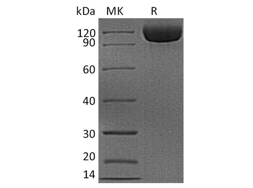 Recombinant Human DPP4/DPPIV/CD26 Protein (His Tag) - ABMIUM