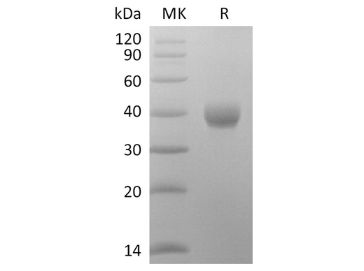 Recombinant SARS-CoV-2 Spike Protein (RBD-SD1, His Tag) - ABMIUM