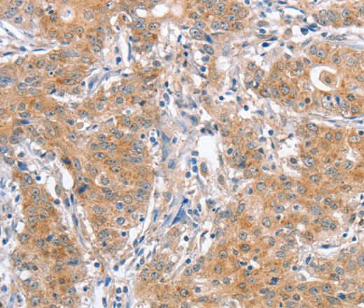 Anti-Human ATG12 Antibody - ABMIUM