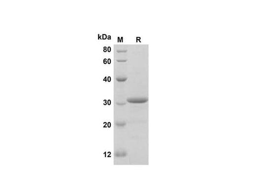 SDS-PAGE analysis of Human NLRP3 proteins, 2 μg/lane of Recombinant Human NLRP3 proteins was resolved with SDS-PAGE under reducing conditions, showing bands at 31 kDa.