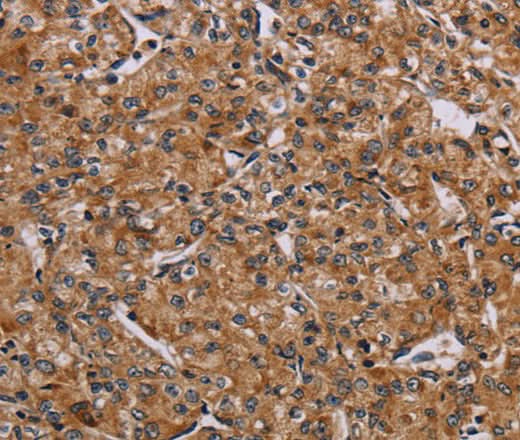 Anti-Human/Mouse AATK Antibody - ABMIUM