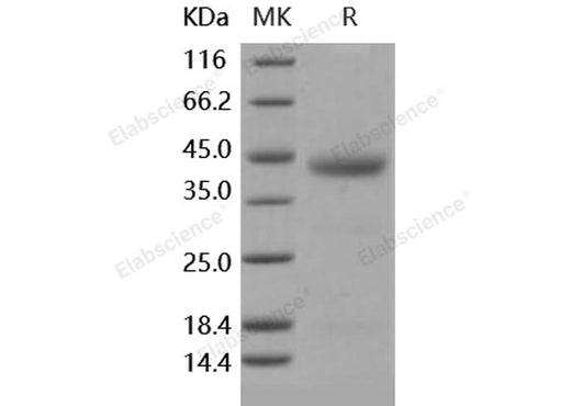 > 92 % as determined by reducing SDS-PAGE.