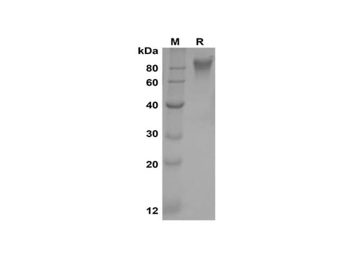 SDS-PAGE analysis of Rhesus macaque B7-H4/VTCN1 proteins, 2 μg/lane of Recombinant Rhesus macaque B7-H4/VTCN1 proteins was resolved with SDS-PAGE under reducing conditions, showing bands at 70-100 kDa.