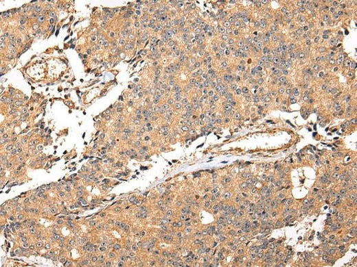 Anti-Human ALDH3A2 Antibody - ABMIUM