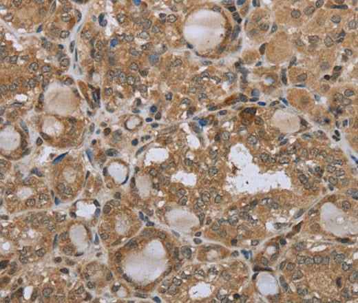 Anti-Human/Mouse STMN2/3/4 Antibody