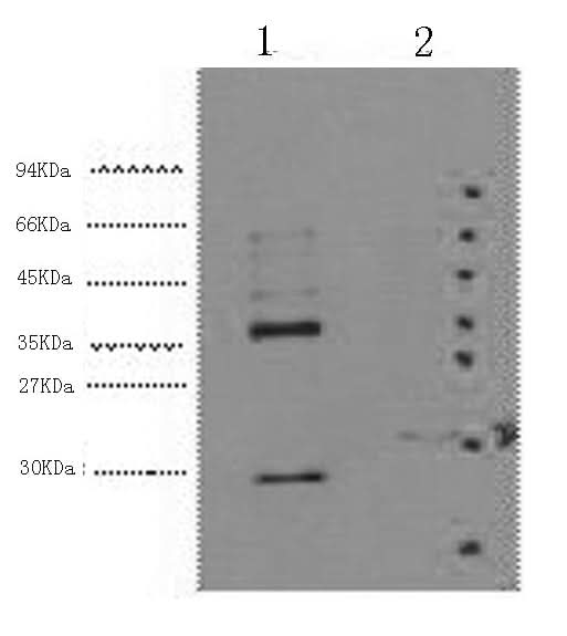 Western Blot analysis of 1) Hela, 2) 293T cells using CA9 Monoclonal Antibody at dilution of 1:5000.