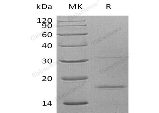 Recombinant Human CXCL9 Protein (His Tag) - ABMIUM