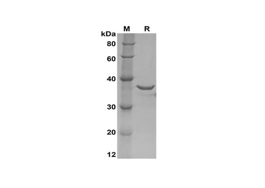 SDS-PAGE analysis of Human IFNα2 proteins, 2 μg/lane of Recombinant Human IFNα2 proteins was resolved with SDS-PAGE under reducing conditions, showing bands at 38 kDa.