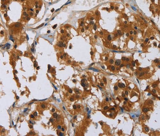 Anti-Human GATA5 Antibody - ABMIUM