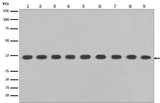 Anti-GAPDH Rabbit Monoclonal Antibody Boster Bio