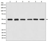 Anti-beta Tubulin Rabbit Monoclonal Antibody Boster Bio