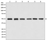 Anti-beta Tubulin Rabbit Monoclonal Antibody Boster Bio