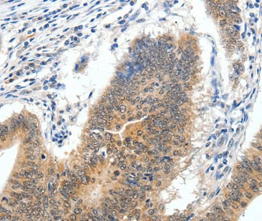 Anti-Human/Mouse ECE2 Antibody - ABMIUM