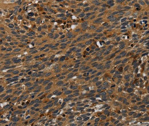 Anti-Human PCDHB15 Antibody - ABMIUM