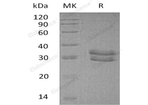 Recombinant Human ITM2B Protein (His Tag) - ABMIUM