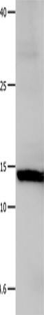 Anti-Human/Mouse/Rat LGALS1 Antibody - ABMIUM