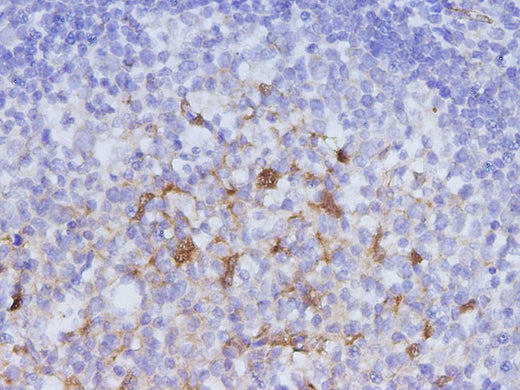 Anti-Human IDO1 Antibody - ABMIUM
