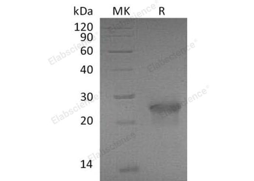 Recombinant Mouse XEDAR/EDA2R Protein (Fc Tag) - ABMIUM