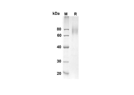 SDS-PAGE analysis of Human IL7R proteins, 2 μg/lane of Recombinant Human IL7R proteins was resolved with an SDS-PAGE under reducing conditions, showing bands at 50.4 kDa.