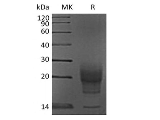 Recombinant Mouse Interleukin-5/IL-5 (C-6His) - ABMIUM