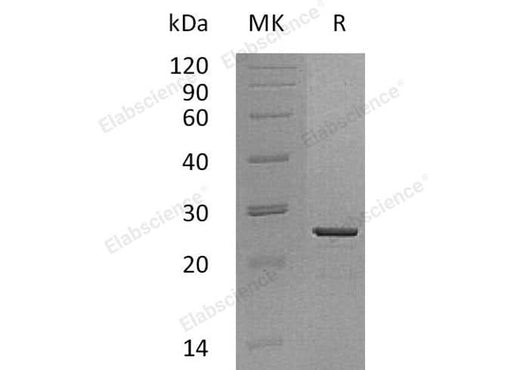 Recombinant Human HMGB3 Protein (His Tag) - ABMIUM